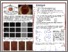 [thumbnail of ReyesAldasoro_MIUA2017_PosterB.pdf]